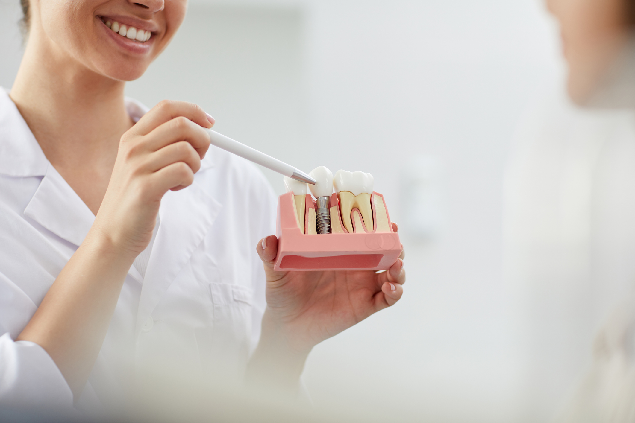 implantes dentales en León