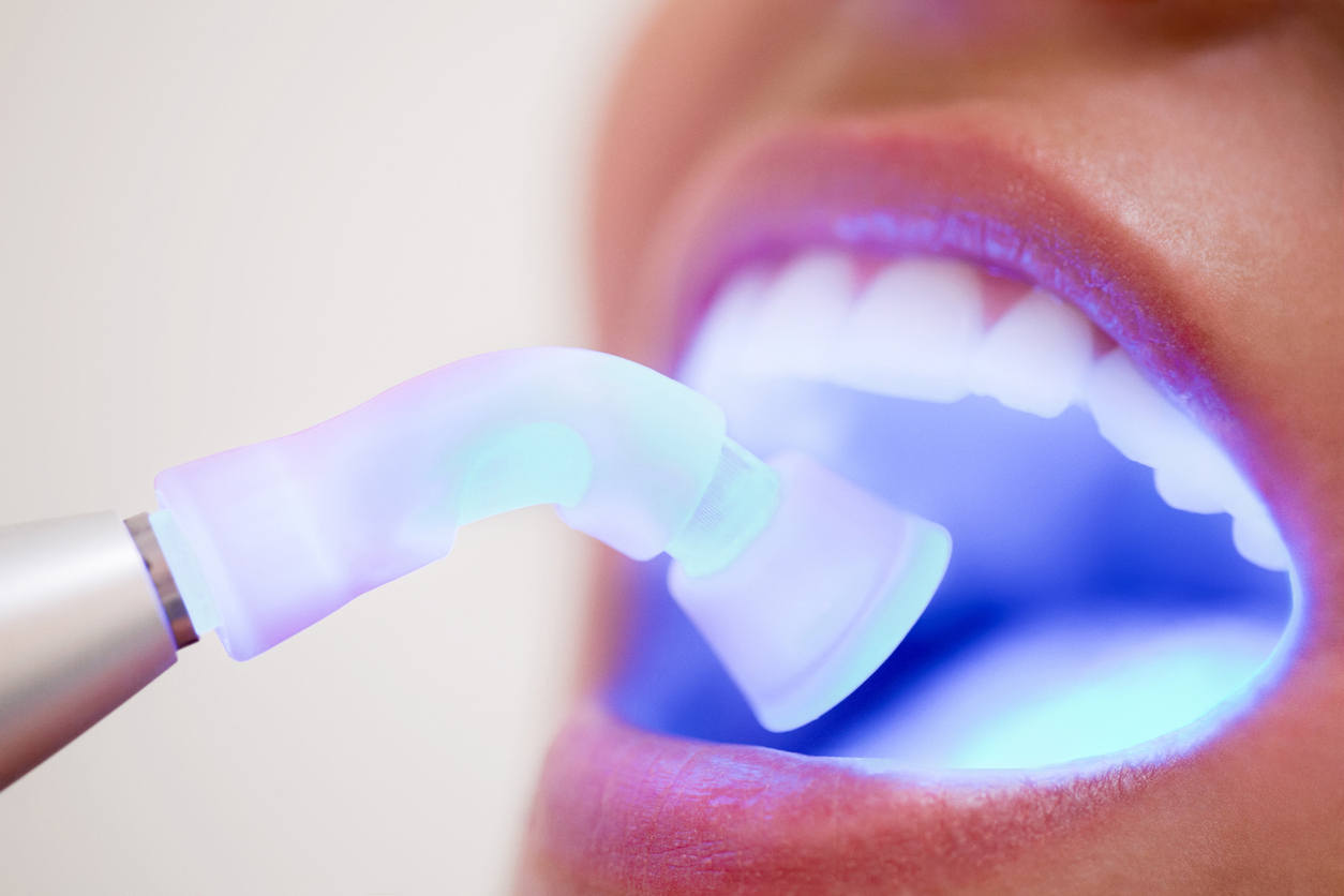 Empastes dentales