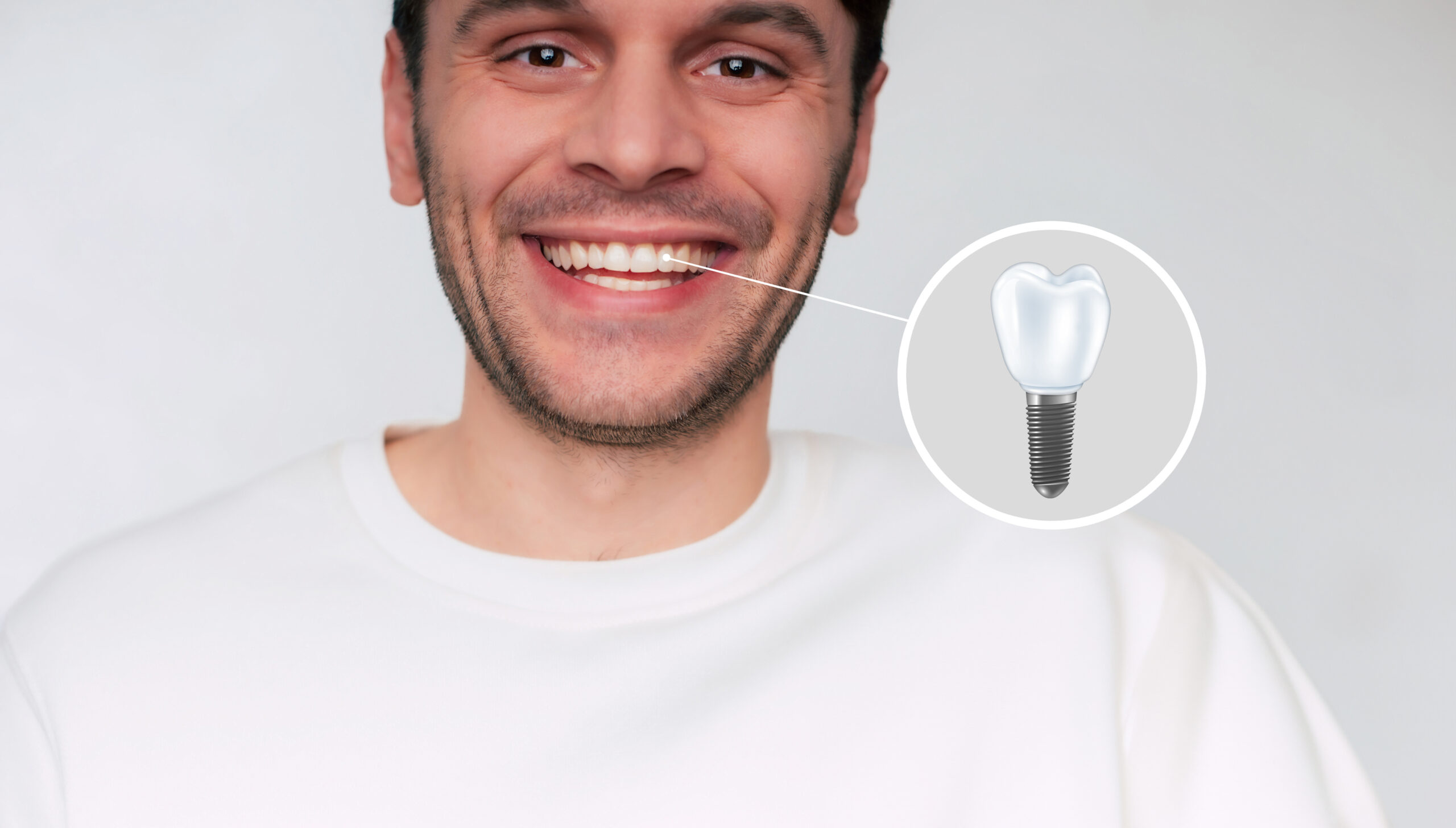 implantes dentales en León