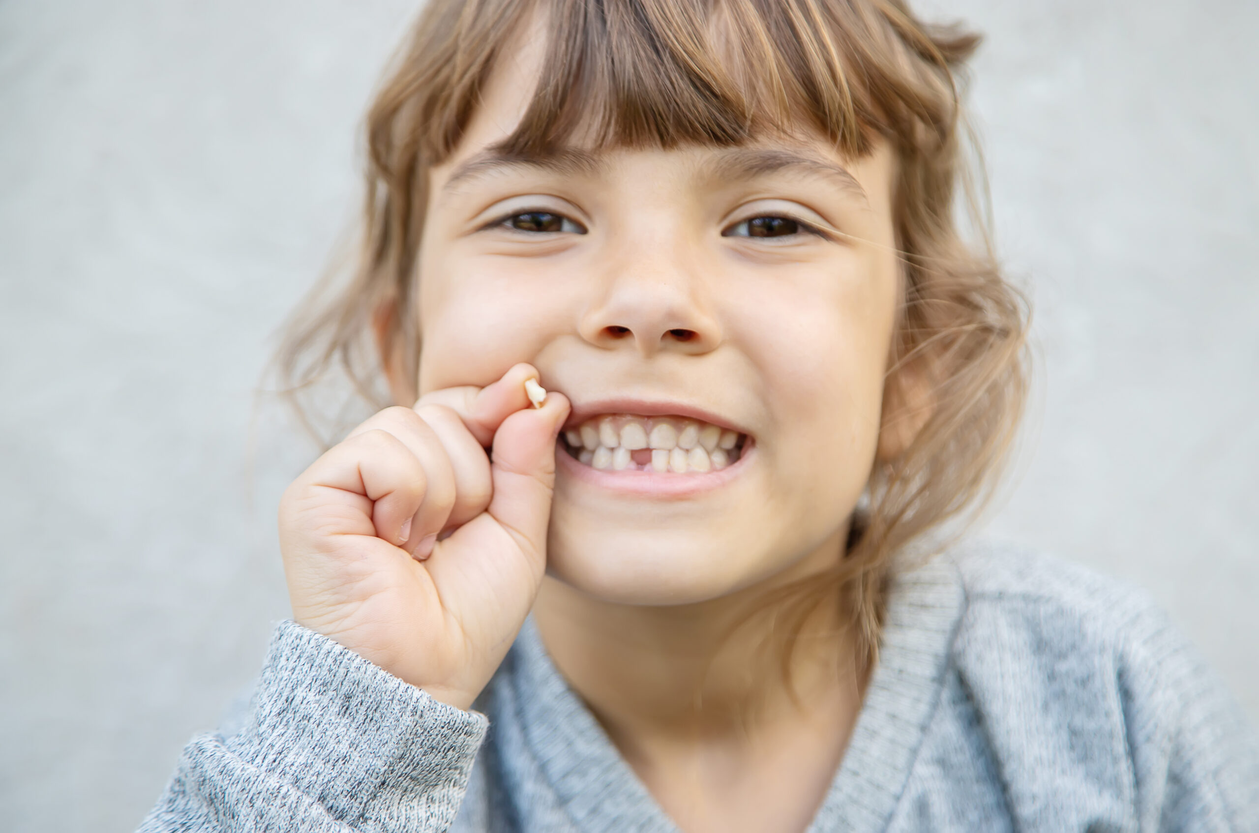 Agenesia dental